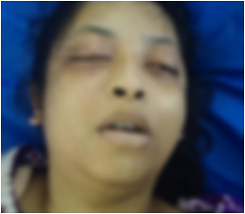 ফরিদপুরে রিকশার চাকায় ওড়না পেঁচিয়ে তরুণীর মর্মান্তিক মৃত্যু